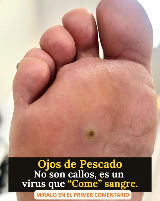 Ojo de Pescado: Una Lesión Pequeña por Fuera, pero Mucho Más Compleja por Dentro.