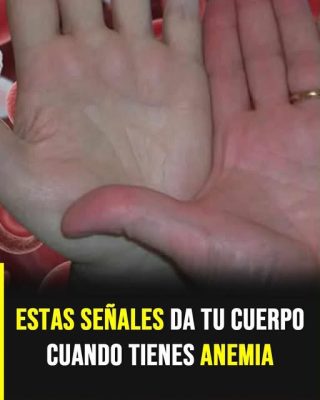 Anemia: las señales silenciosas que pueden indicar falta de oxígeno en la sangre