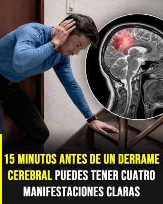 Tu cuerpo te puede avisar si es que sufrirás un derrame