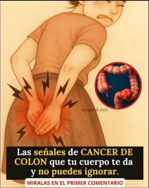 Cáncer de colon: ¿Por qué afecta cada vez a más