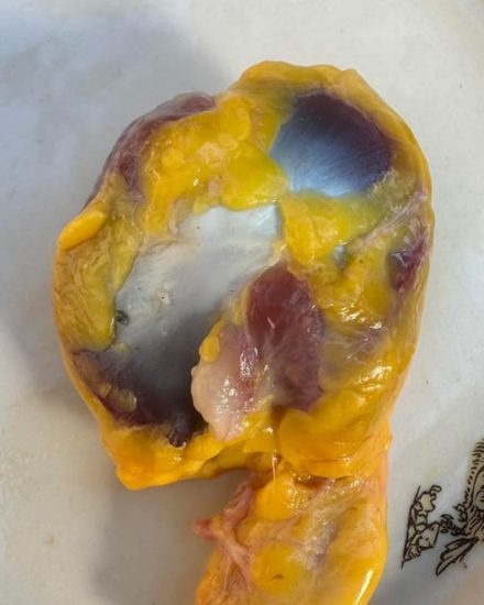 Sabías que si consumes las mollejas de pollo no tienes que tomar…