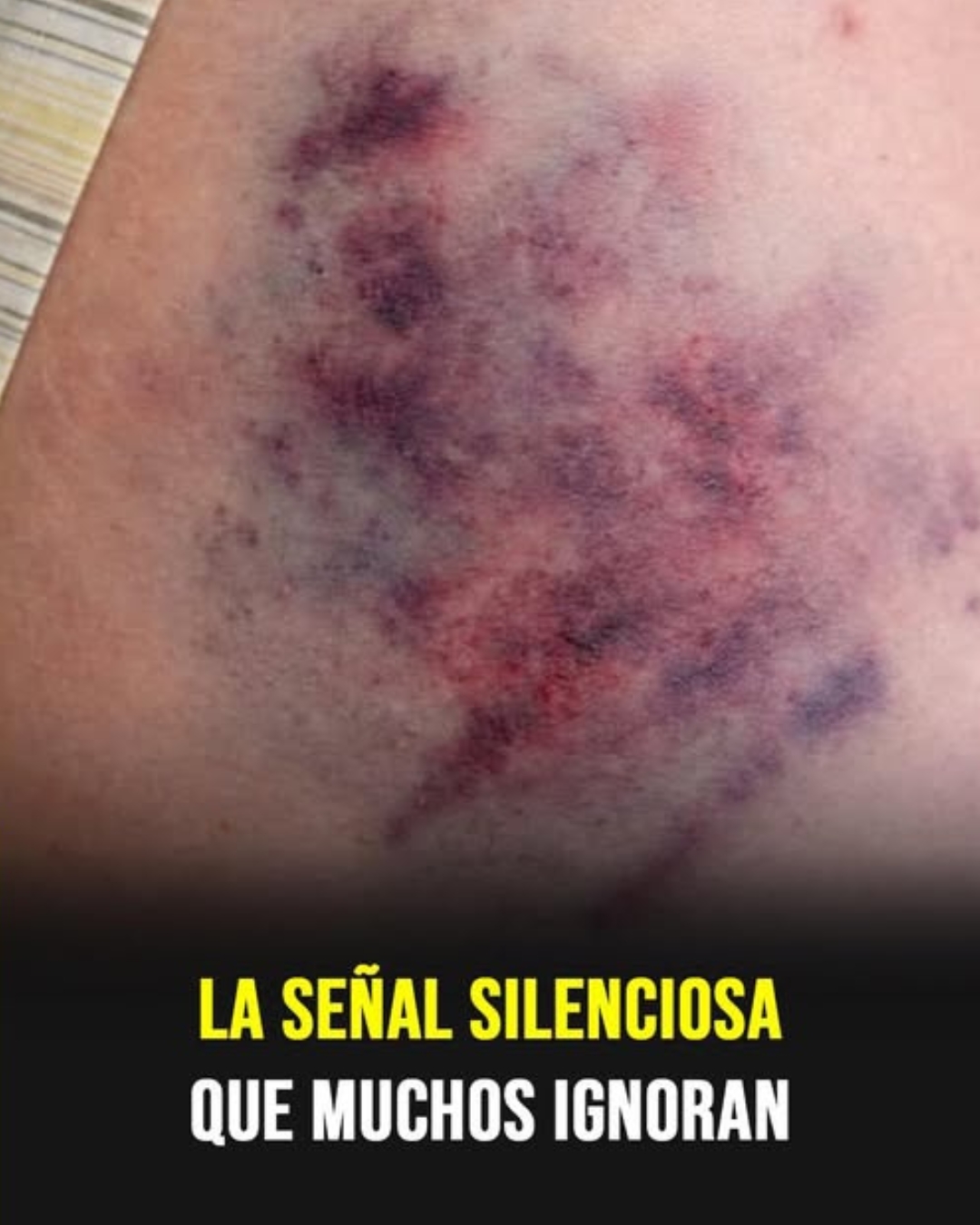 Qué es la Leucemia? Causas, Síntomas y Cómo Prevenir Esta Enfermedad.