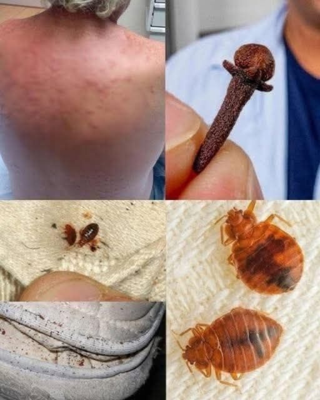 No dejes que los ácaros en tu cama y ropa te coman vivo! Rocíales esto y no volverás a saber de ellos