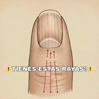 Si tienes las uñas con estas lineas debes poner atención