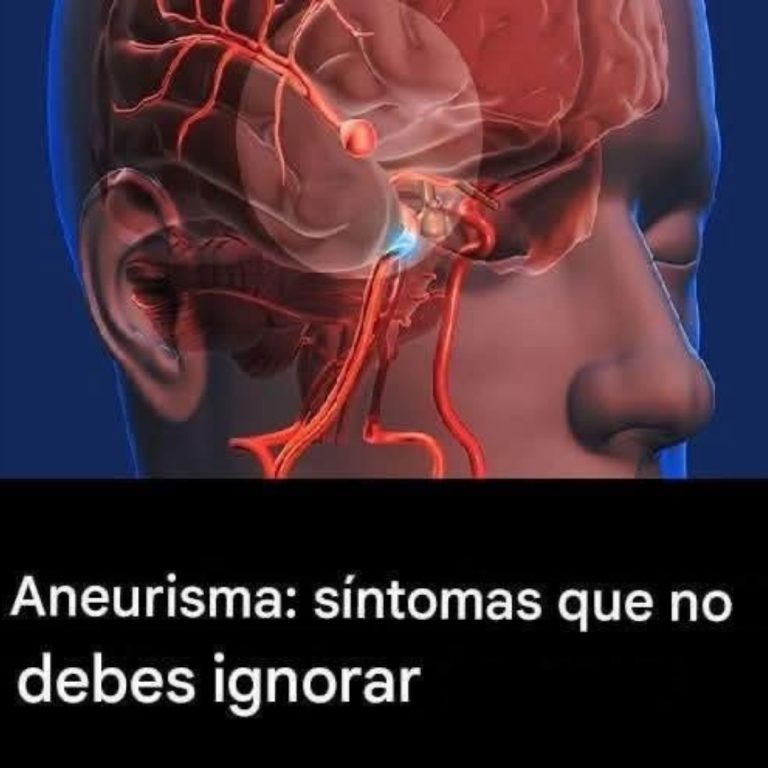Un derrame te avisa un mes antes y el 99% de las personas no lo saben