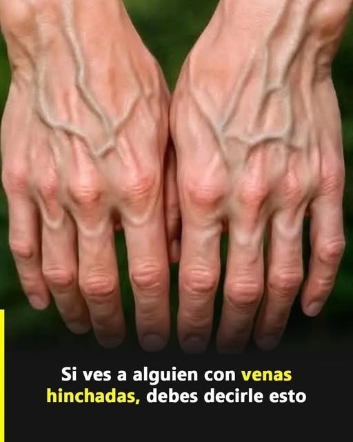 Por Qué Algunas Personas Tienen las Venas de las Manos Muy Marcadas? Descúbrelo Aquí.