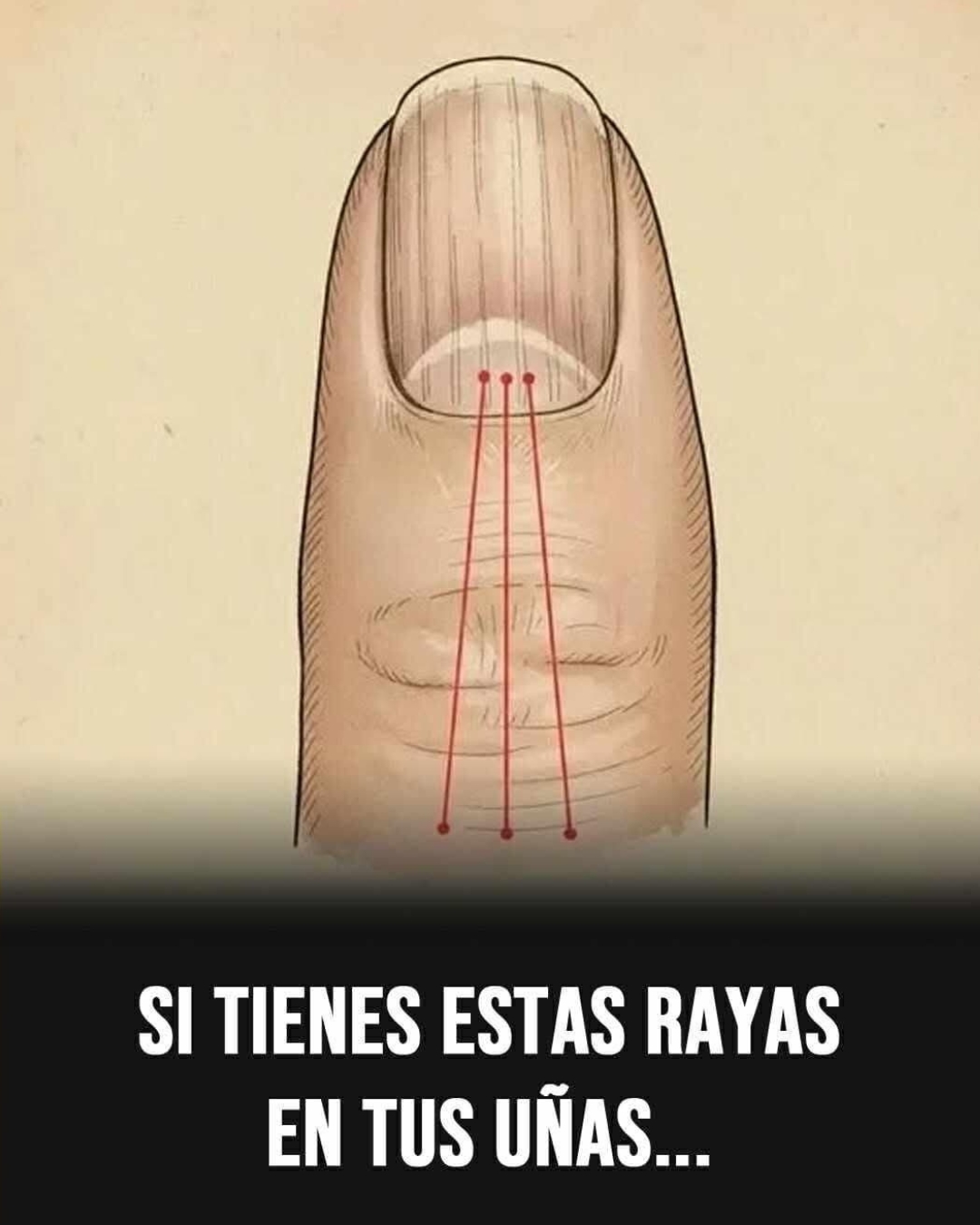 Si tienes las uñas con estas lineas debes poner atención