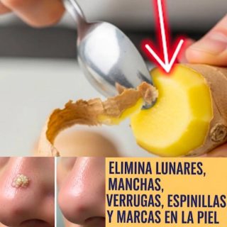 Olvídate de las cirugías: esto es lo que tienes que hacer para eliminar una verruga