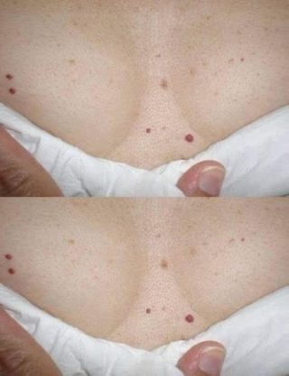MEJOR SERA QUE SEPAS ESTO SI TIENES UNO DE ESTOS PUNTOS ROJOS EN TU CUERPO.