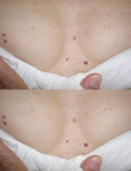 MEJOR SERA QUE SEPAS ESTO SI TIENES UNO DE ESTOS PUNTOS ROJOS EN TU CUERPO.