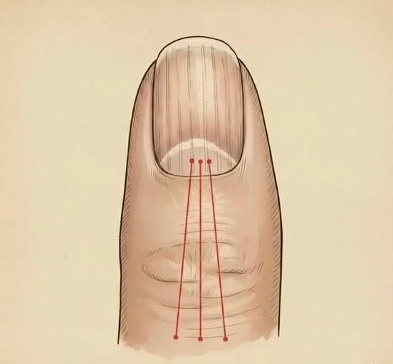 Si tienes las uñas con estas lineas debes poner atención