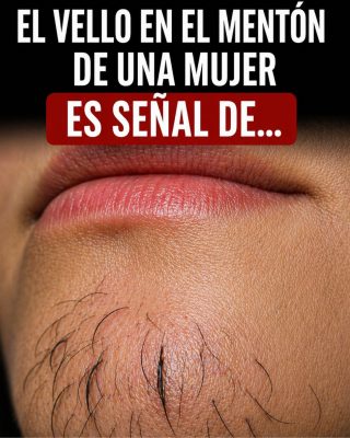 ¿Por Qué Le Salen Vellos en la Cara a Algunas Mujeres? Causas y Soluciones