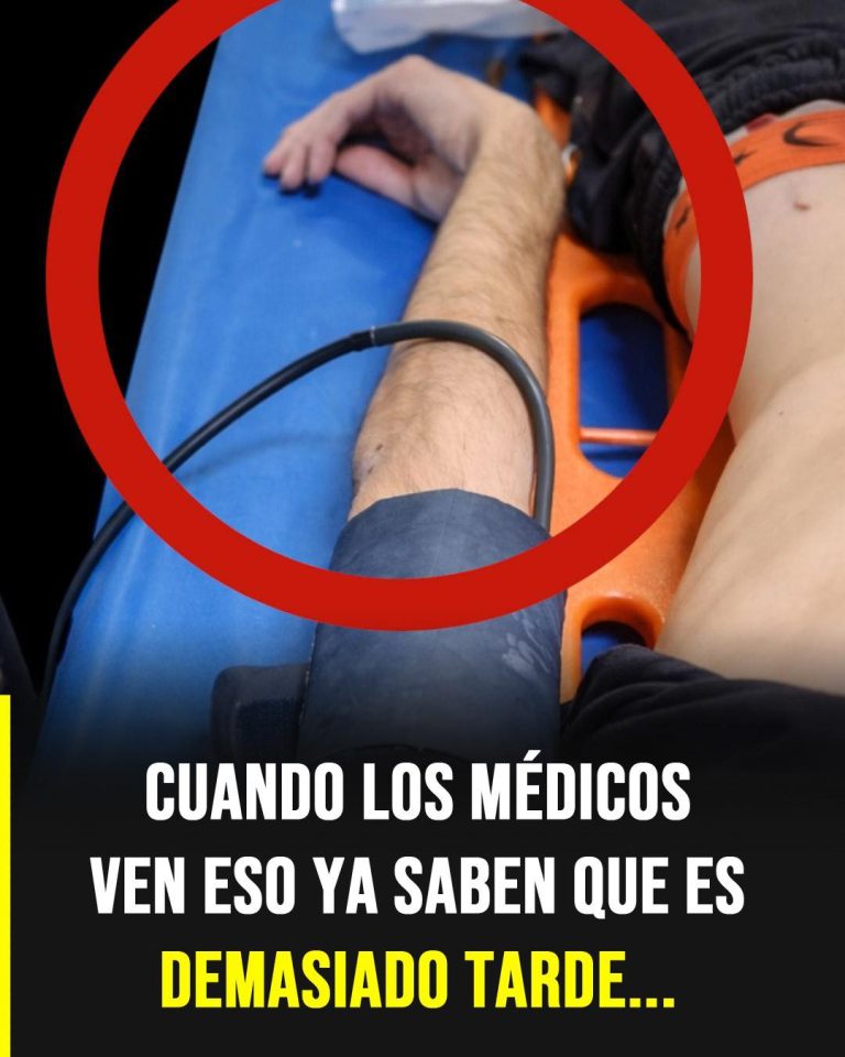 Postura de descerebración: la señal neurológica crítica que alerta sobre un daño cerebral grave