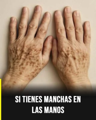 Manchas en las manos: señales visibles que podrían reflejar tu estado de salud