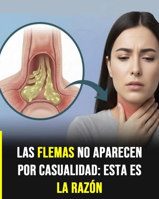 Cómo aliviar y reducir la flema en la garganta de forma efectiva y segura