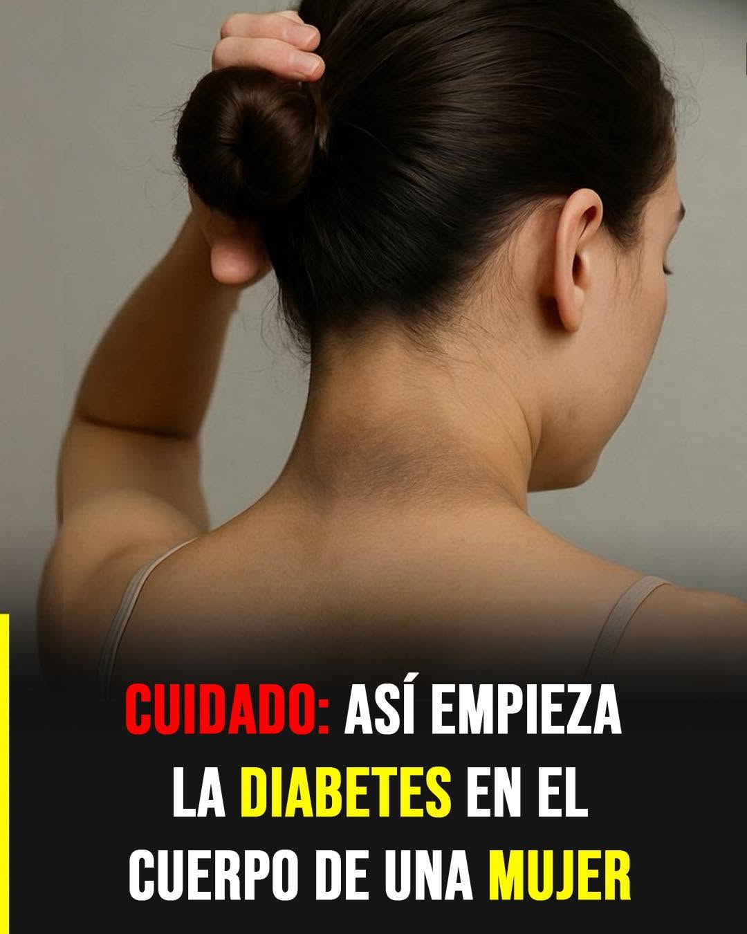 Manchas oscuras en pliegues del cuerpo: cuando la piel envía una señal de alerta
