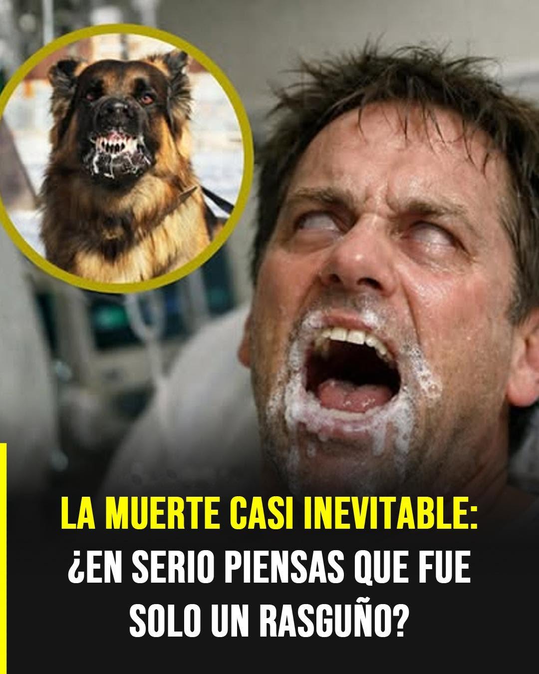 Rabia humana: la enfermedad silenciosa que puede comenzar con una mordida mínima
