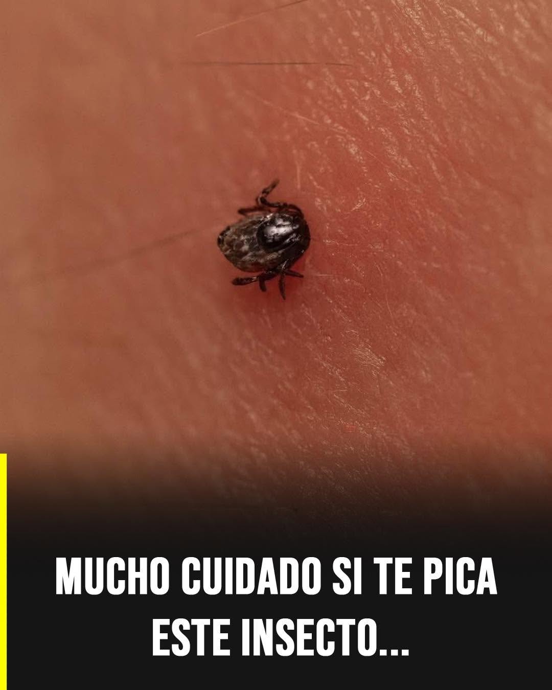 Enfermedad de Lyme: qué la causa, cómo tratarla de forma natural y las claves para evitarla