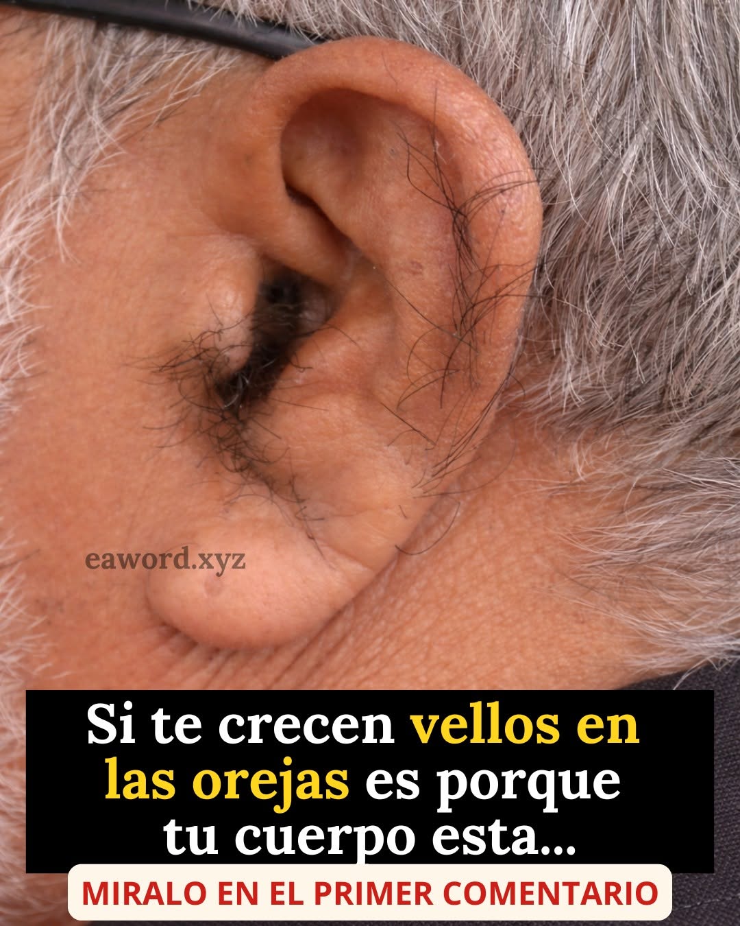 ¿Por qué aparecen vellos en las orejas y qué puede decir de tu salud?