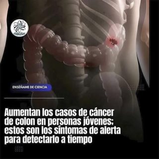 «¡Desintoxica tu Colon Naturalmente! Descubre estos 5 Alimentos Clave»
