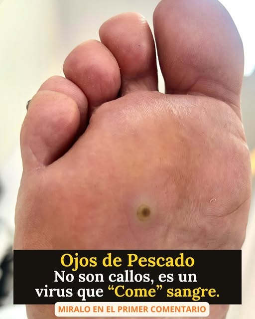 Ojo de Pescado: Una Lesión Pequeña por Fuera, pero Mucho Más Compleja por Dentro.