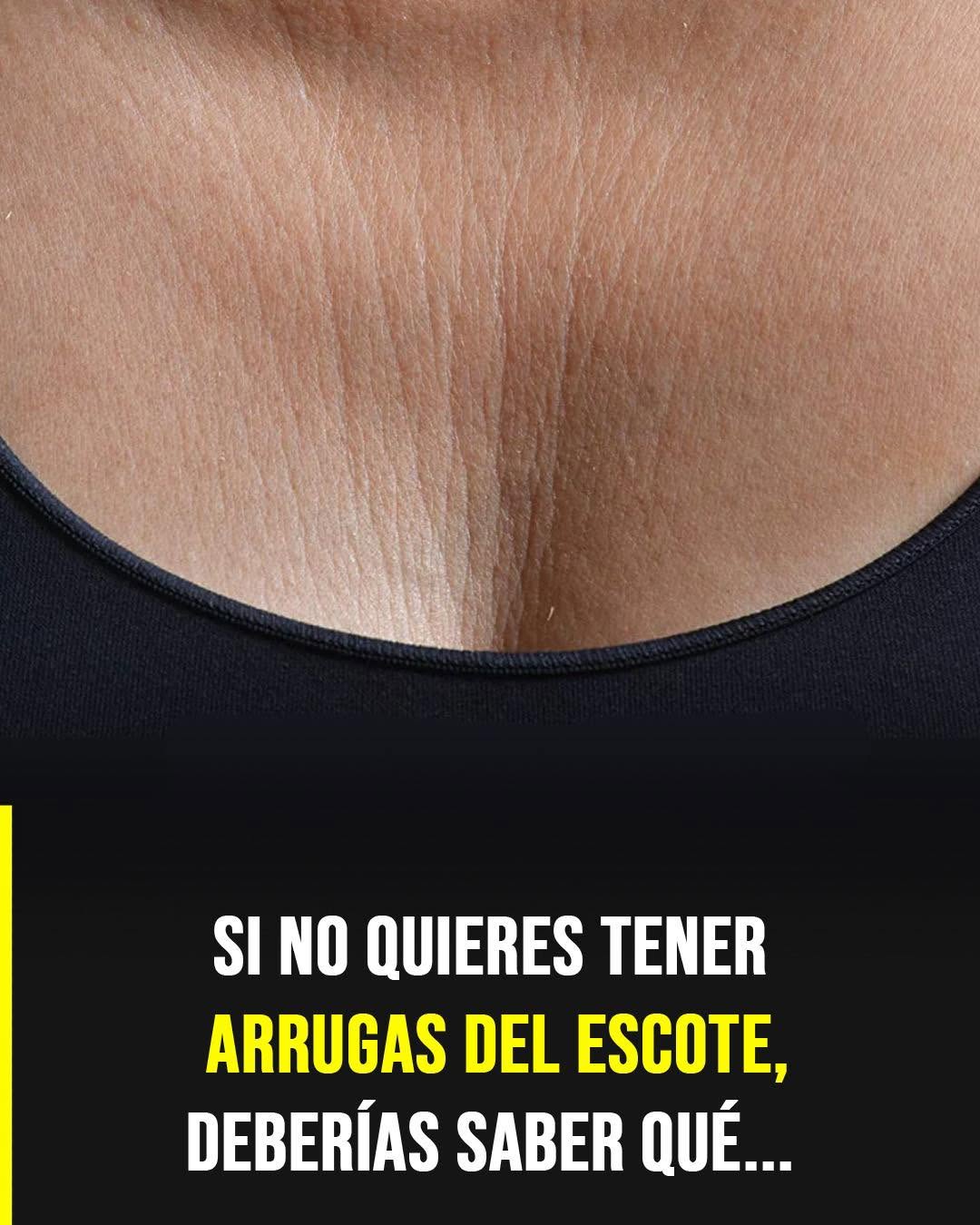 Arrugas del escote: 5 consejos para prevenirlas y mejorar su apariencia