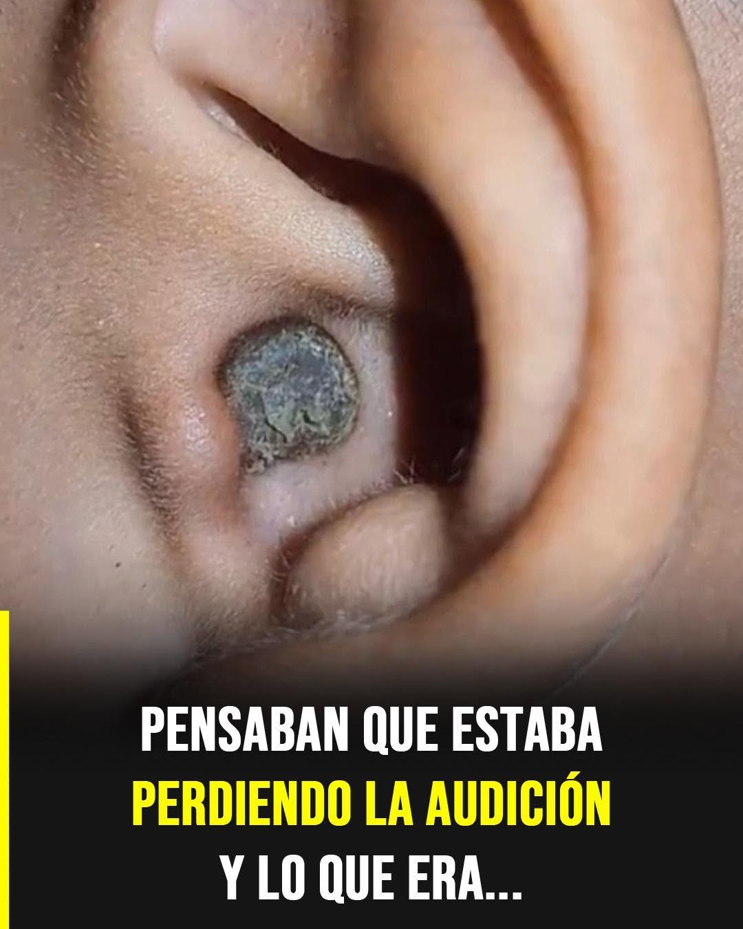 Pérdida de audición en adultos mayores: cuando el problema no es el oído