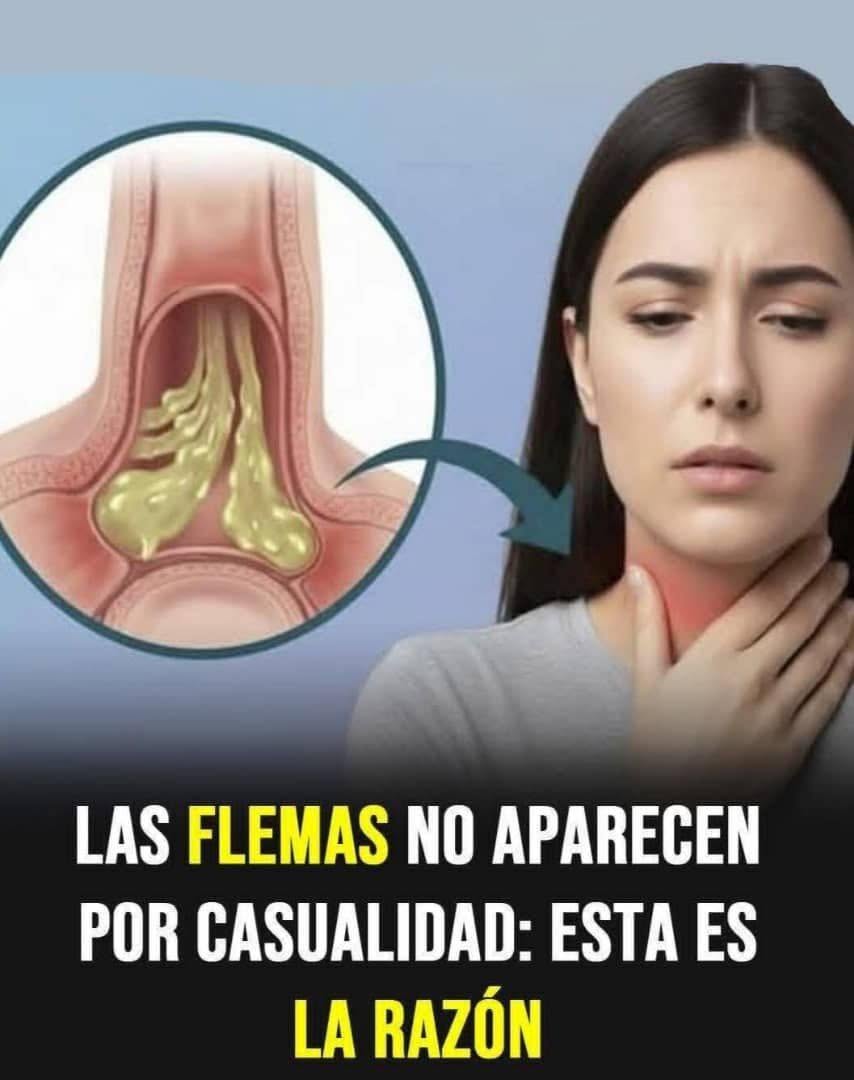 Las 4 CAUSAS de MUCOSIDADCONSTANTE en la GARGANTA.