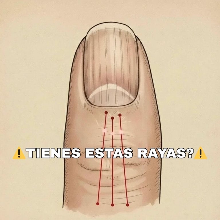 Si tienes las uñas con estas lineas debes poner atención
