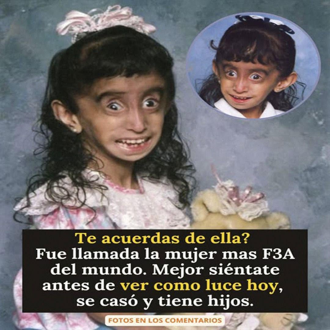 De víctima a inspiración: Lizzie Velásquez y su poderosa lección a los haters