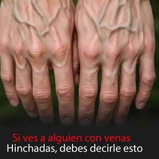 ¿Tus venas se ven más de lo normal? Esto es lo que tu cuerpo podría estar tratando de decirte