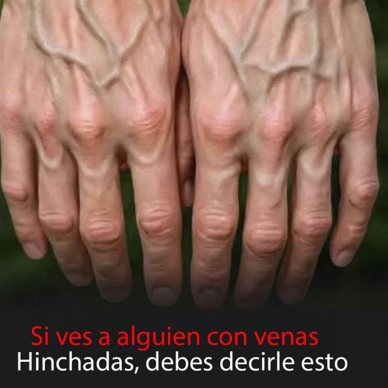 ¿Tus venas se ven más de lo normal? Esto es lo que tu cuerpo podría estar tratando de decirte