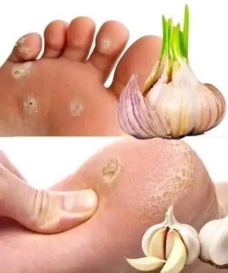 Lo Que tus Pies Revelan: Señales de Problemas de Salud y Remedios Naturales que Ayudan