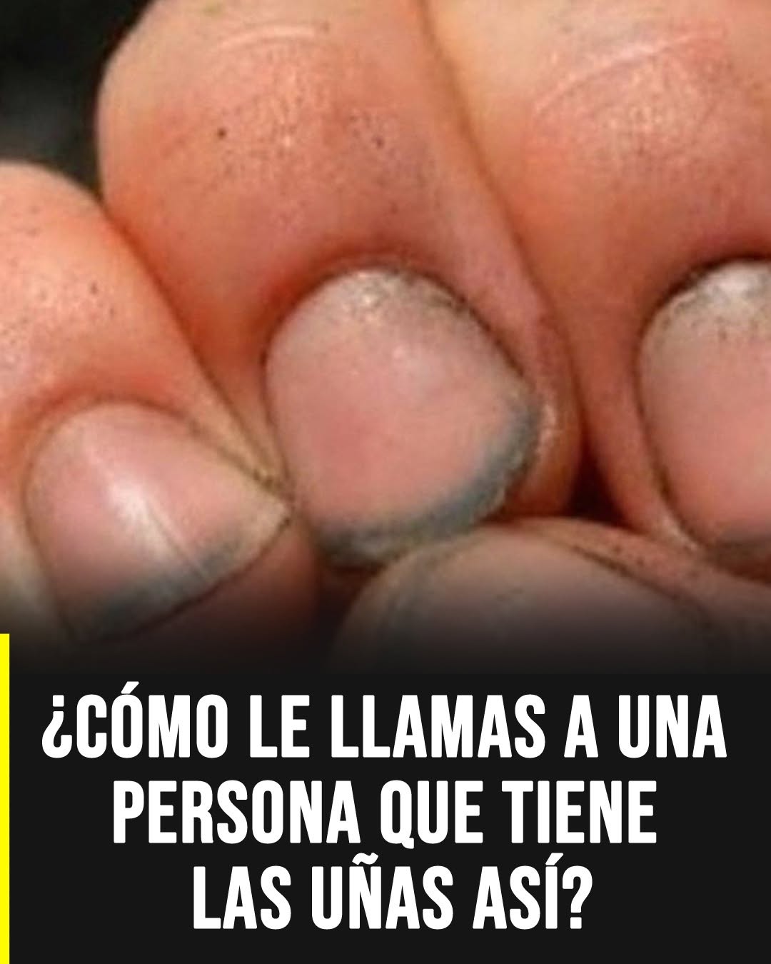 Lo que revelan las uñas descuidadas y por qué muchas personas las interpretan de forma equivocada