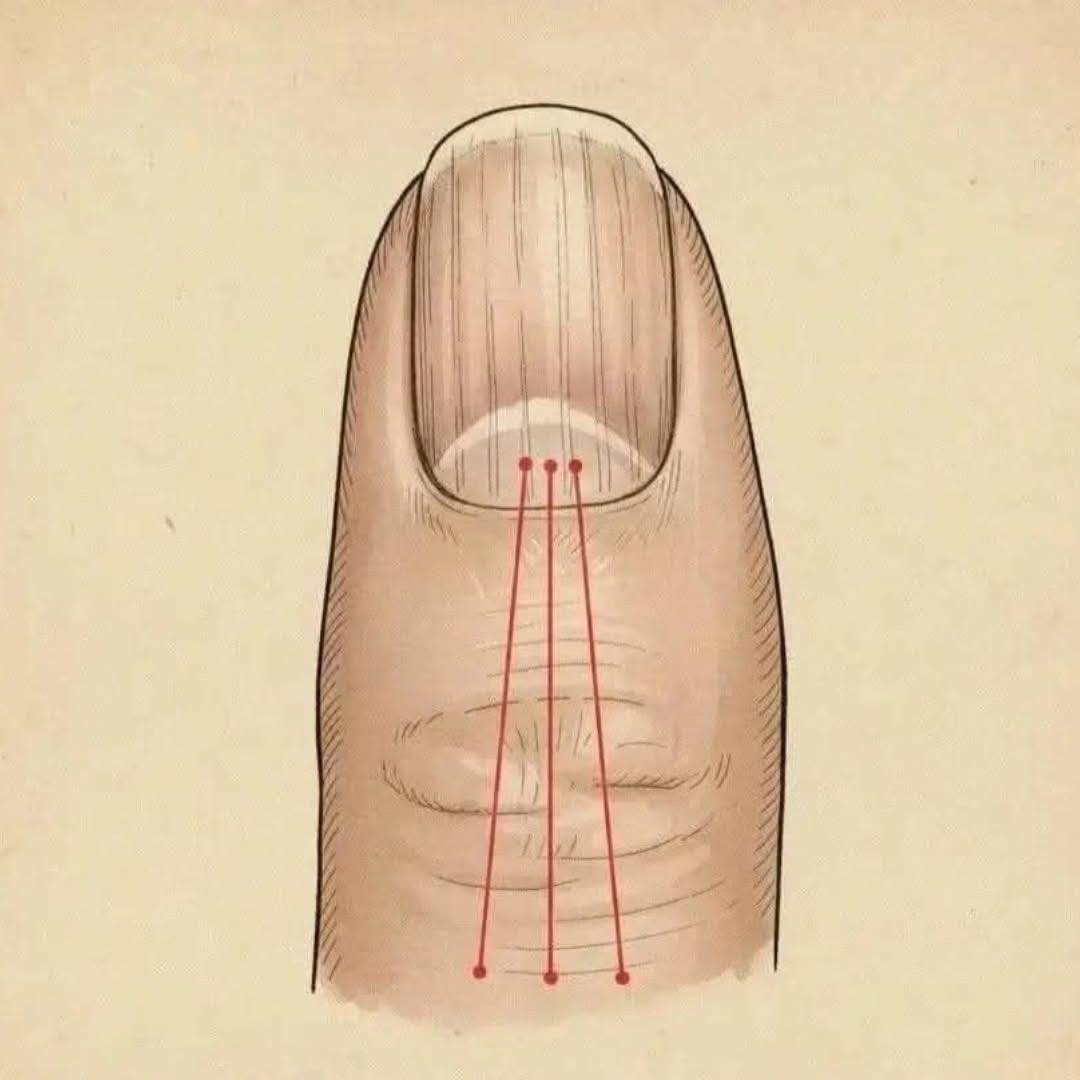 Si tienes las uñas con estas lineas debes poner atención