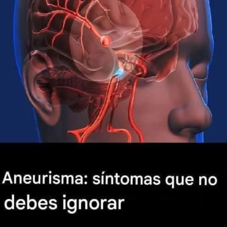 Un derrame te avisa un mes antes y el 99% de las personas no lo saben