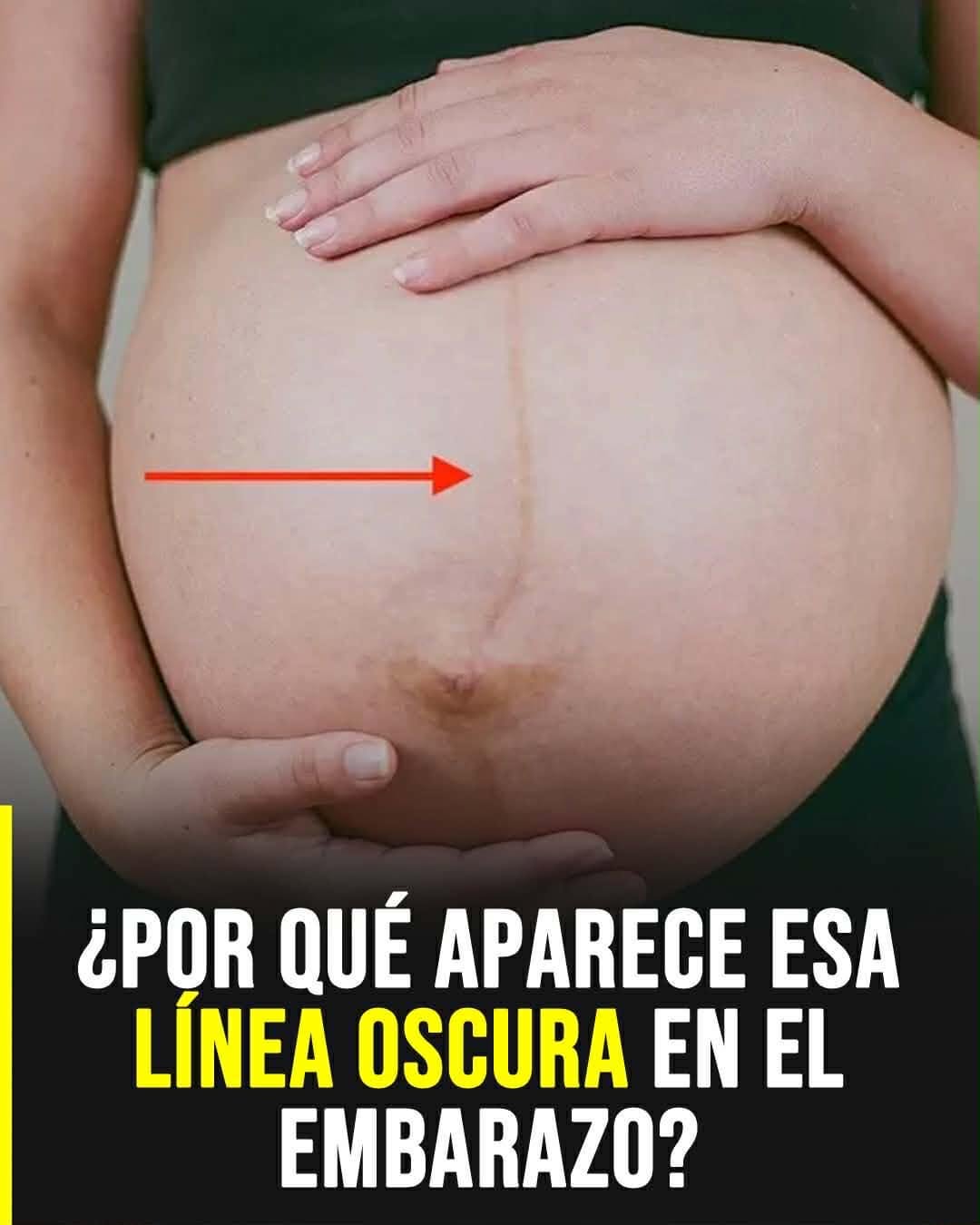 La línea oscura en el embarazo: por qué aparece en la panza y qué significa realmente