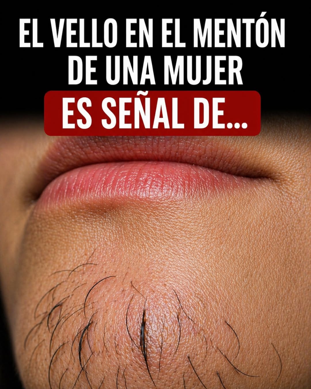 ¿Por Qué Le Salen Vellos en la Cara a Algunas Mujeres? Causas y Soluciones
