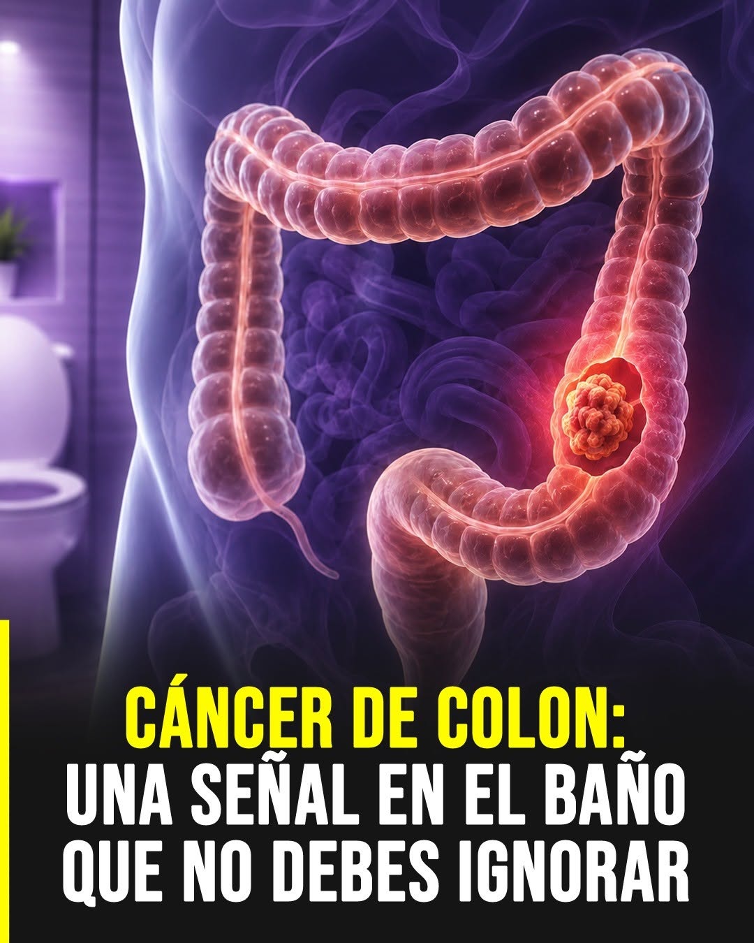 Cáncer de colon: señales de alerta temprana que merecen atención médica