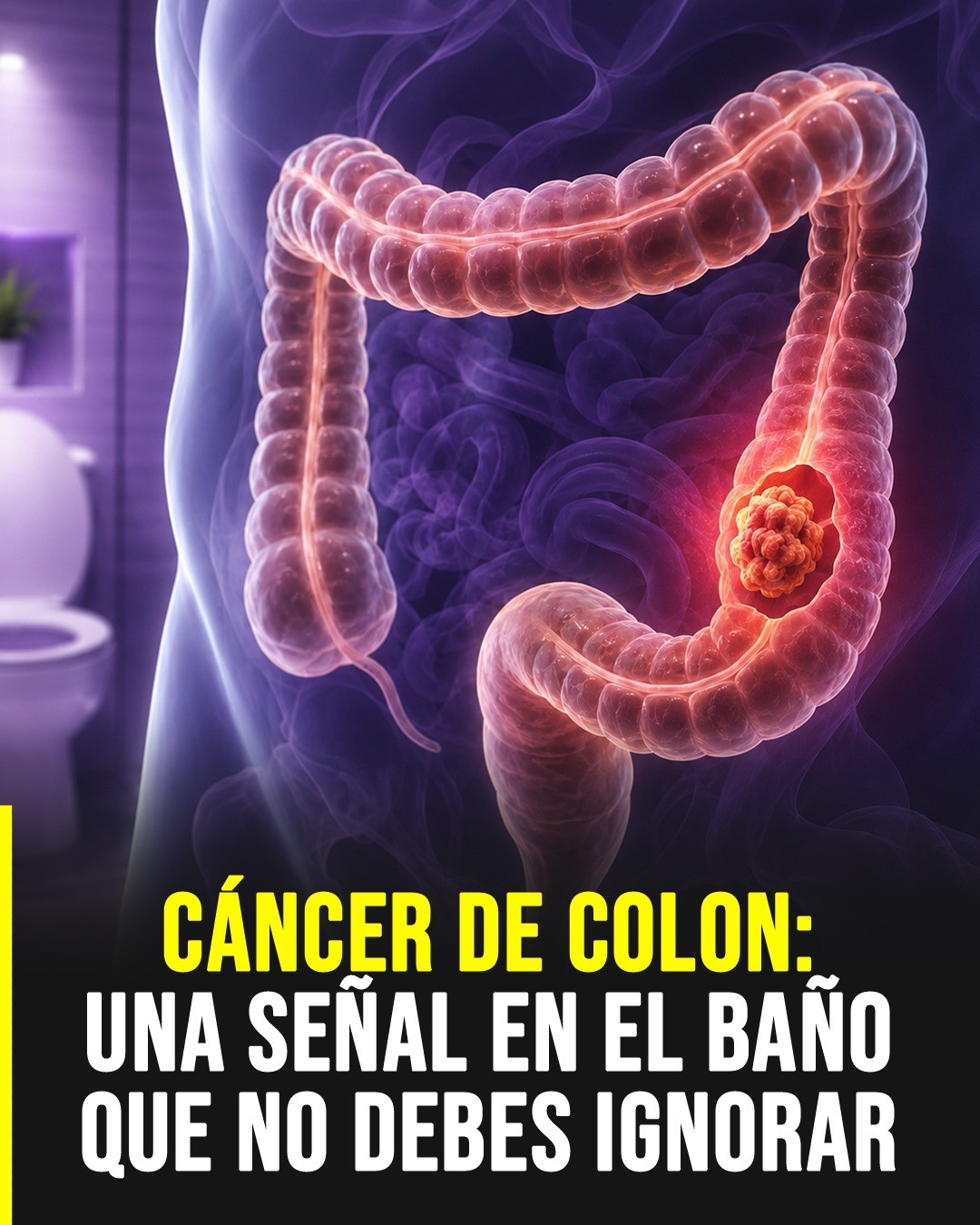 Cáncer de colon: señales de alerta temprana que merecen atención médica
