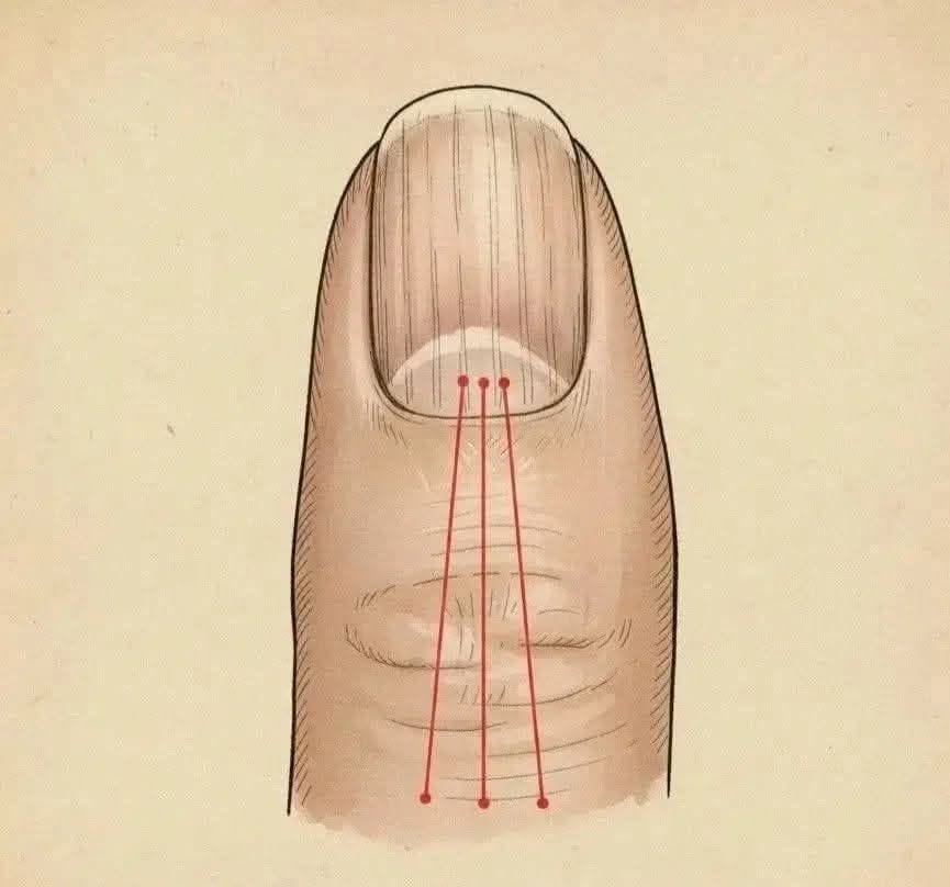 Si tienes las uñas con estas lineas debes poner atención