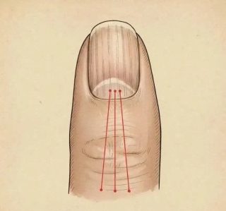 Si tienes las uñas con estas lineas debes poner atención
