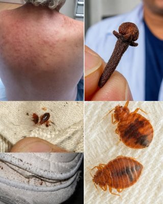 No dejes que los ácaros en tu cama y ropa te coman vivo! Rocíales esto y no volverás a saber de ellos