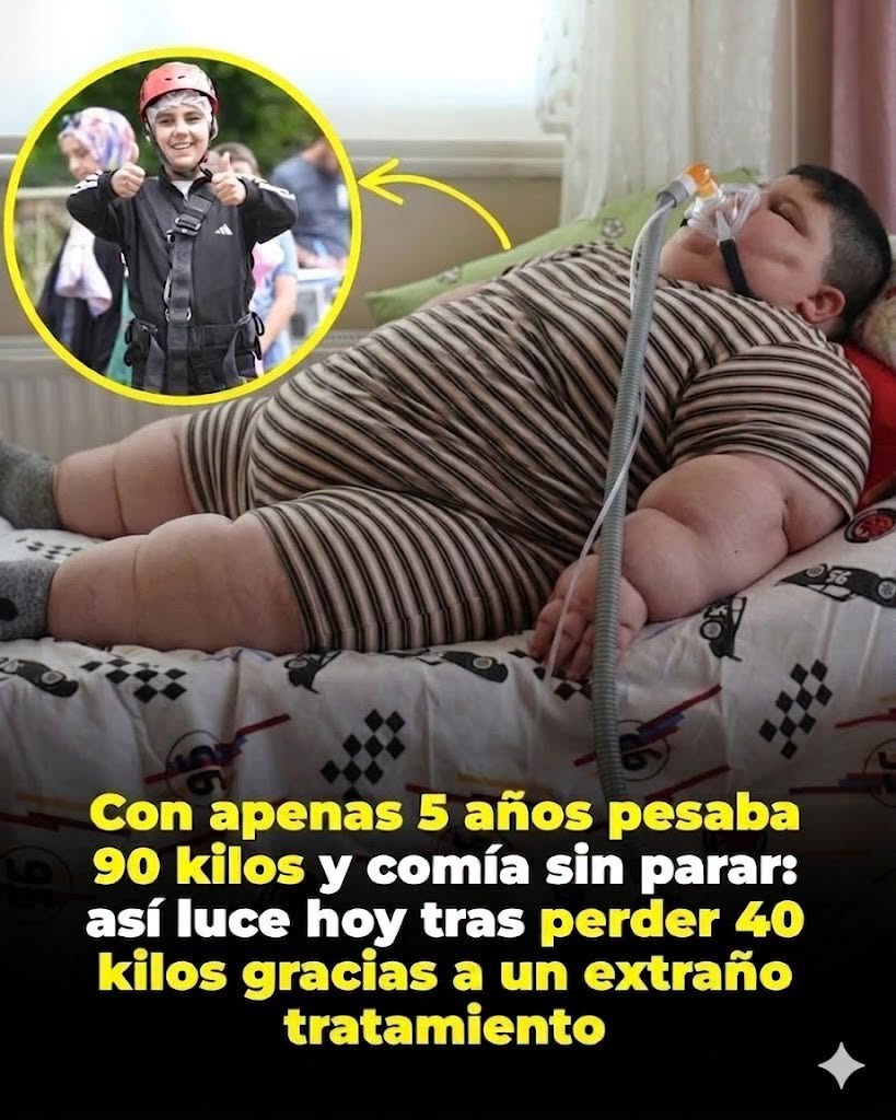 Con apenas 5 años pesaba 90 kilos y comía sin parar: así luce hoy tras perder 40 kilos gracias a un extraño tratamiento
