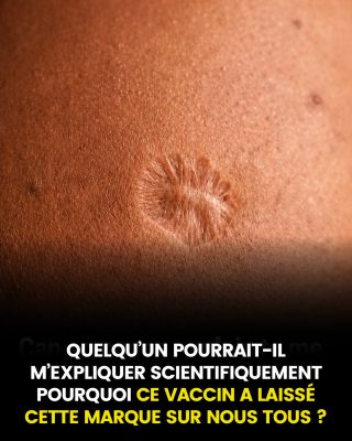 Cicatrice du vaccin contre la variole : pourquoi cela se produit-il ?