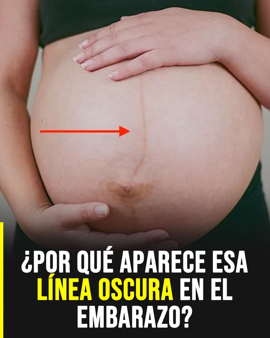 La línea oscura en el embarazo: por qué aparece en la panza y qué significa realmente