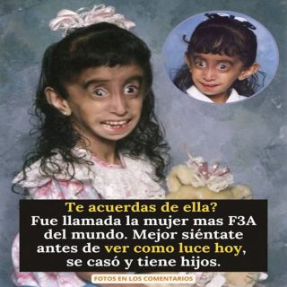 De víctima a inspiración: Lizzie Velásquez y su poderosa lección a los haters
