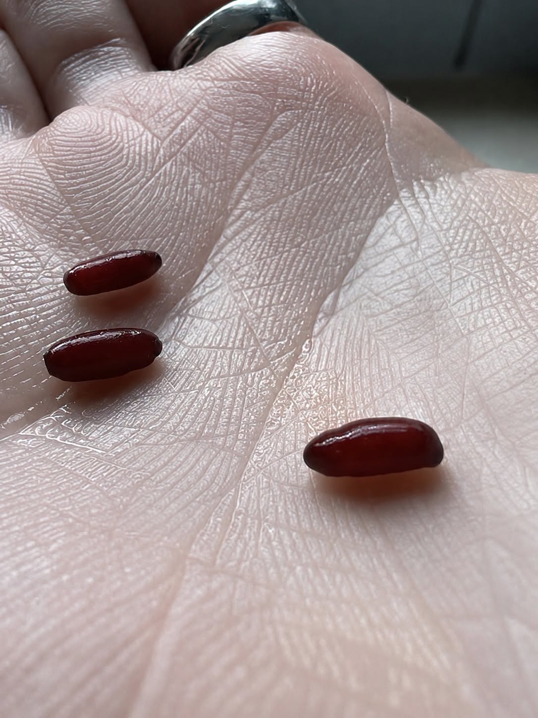 Encontré unos objetos extraños y brillantes en mi cama: qué pueden ser y cómo identificarlos