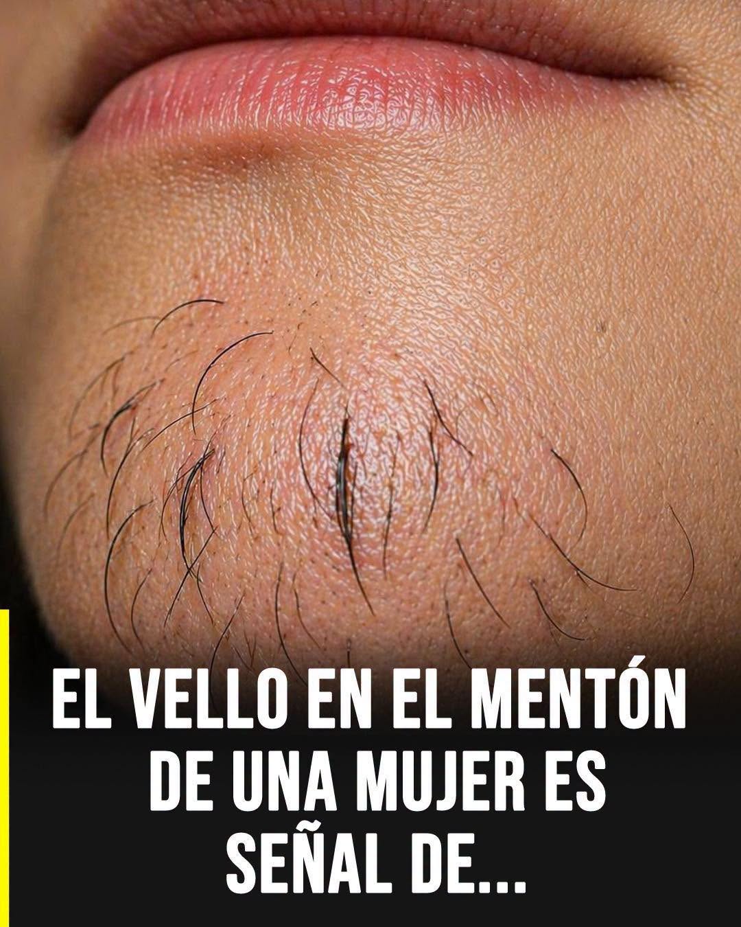 Vello en la Barbilla Femenina: Causas, Señales y Soluciones