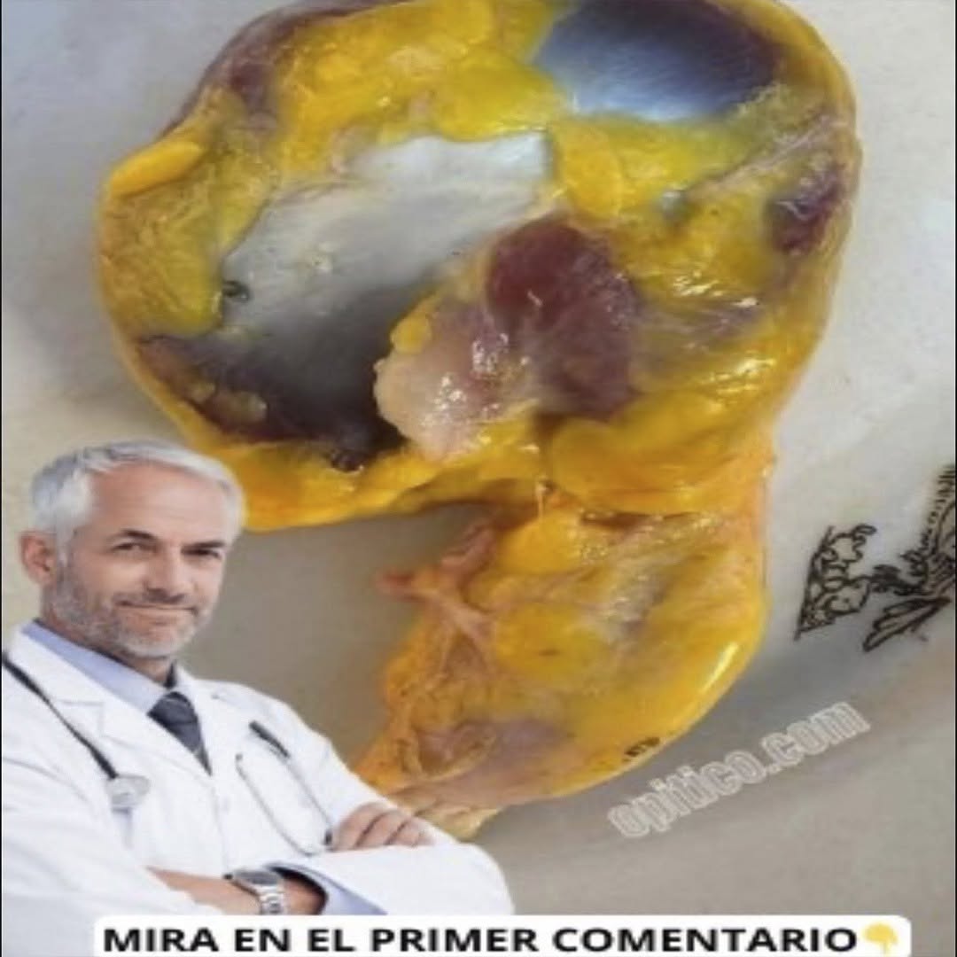 Por qué deberías comer mollejas de pollo ya mismo: un tesoro olvidado en tu cocina